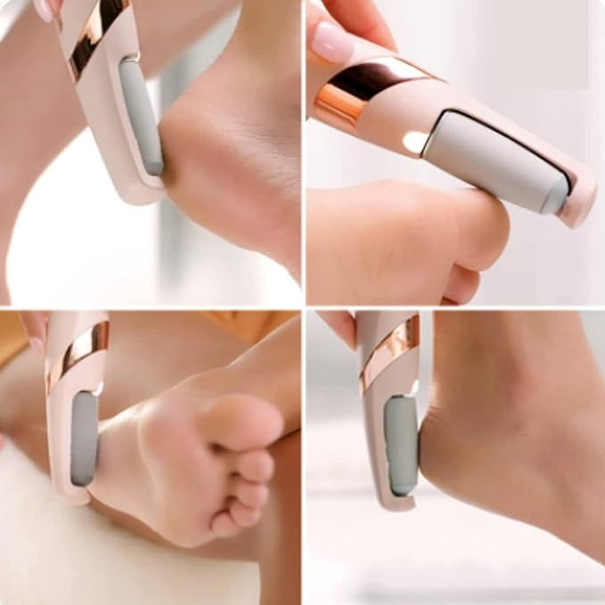 Foot Roller Callus Remover Hard and Dead Skin Remover